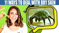 11 Ways To Deal With Dry Skin - Anoushey Ashraf